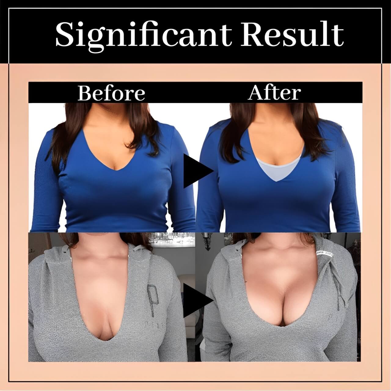 Posture Bra Wireless Lift Up – Comparison